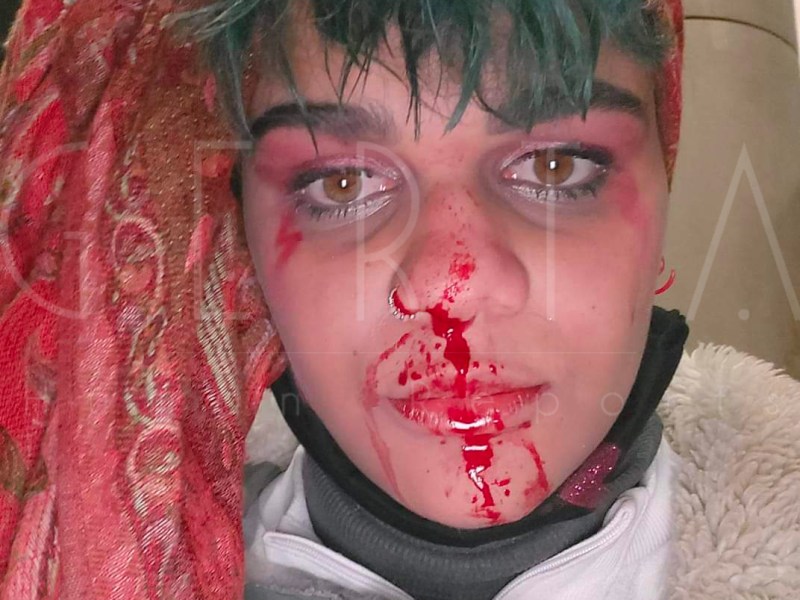 POLAND: VIOLENCE AND ARRESTS DURING THE STRIKES AGAINST THE REFORM OF ABORTION LAW. THE STORY OF OLIVIA MASOJA&nbsp;(Eng/Ita)